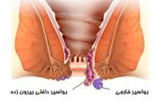 دکتر علی قزوینی فوق تخصص ریه