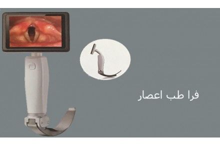 لارنگ اسکوپ ویدئویی