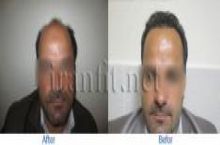  کلينيک بين المللي ايران فيت 