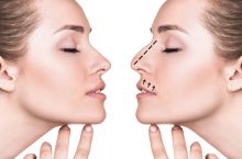 دکتر رضا وارسته کیا فوق تخصص جراحی پلاستیک،ترمیمی و زیبایی