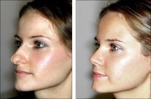دکتر علی ابراهیمی فوق تخصص جراحی پلاستیک،ترمیمی و زیبایی