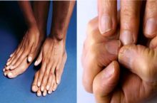 دکتر سپیده ترامشلو پور متخصص کایروپراکتیک