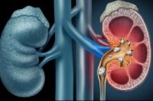 دکتر فریدون خیام فر متخصص اورولوژی، جراحی کلیه و مجاری ادراری