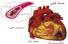 دکتر محمدرضا خالدیان فوق تخصص قلب و عروق